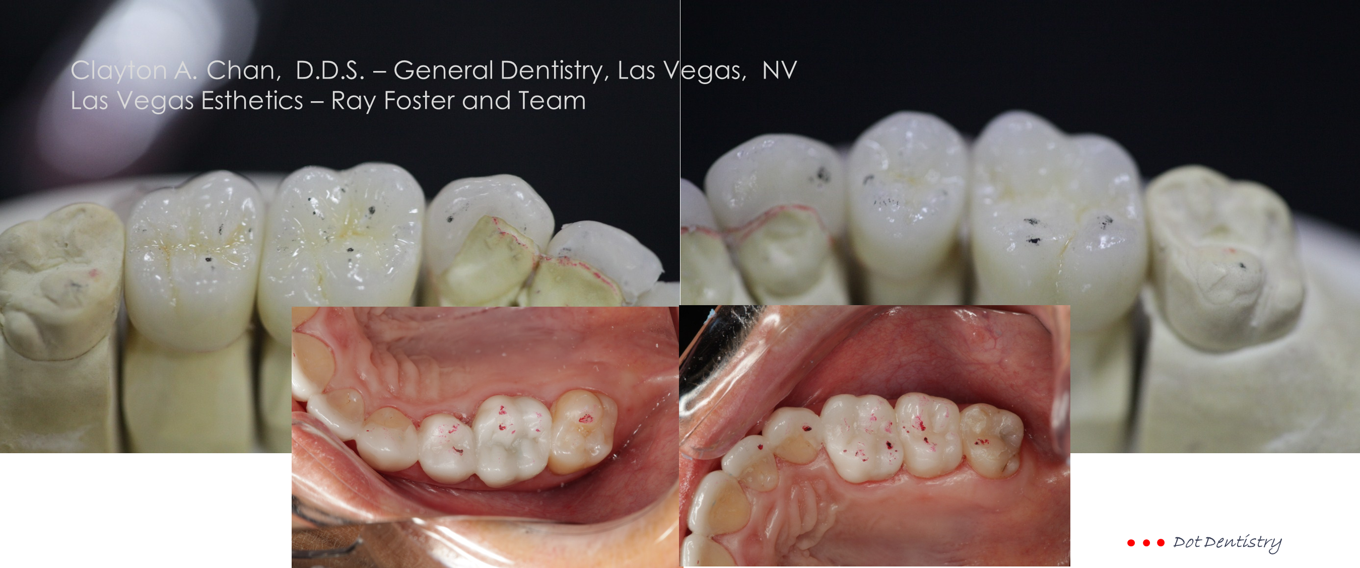 Pain Behind the Eyes: Retro Orbital Pain | Occlusion Connections™