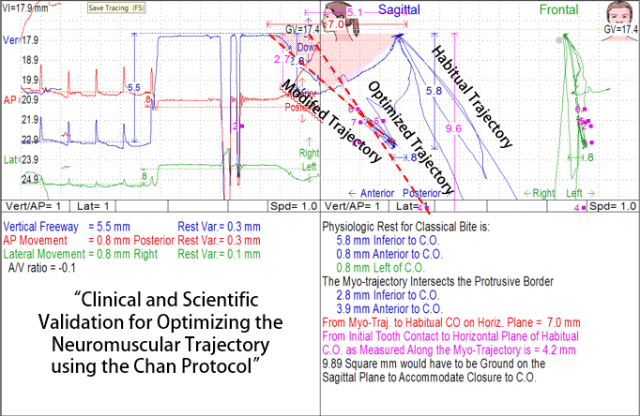 myo-habitual-optimized-