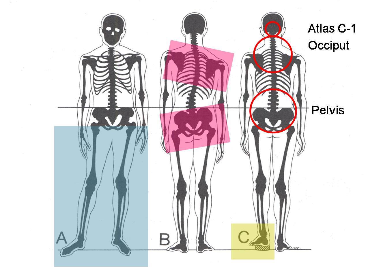 TMJ Occlusion Posture and Airway Occlusion Connections
